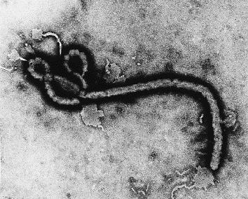 Hemorrhagic Viruses Ebola, Marburg, Yellow Fever, Lassa Viral syndrome with hemorrhagic complications High fatalities with Ebola