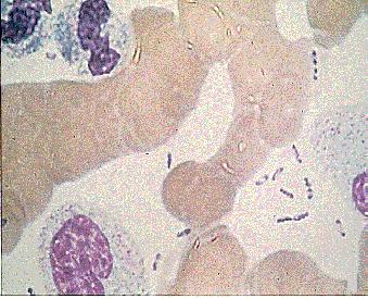 Plague-Yersinia pestis World Health Organization, CDC PHIL #463