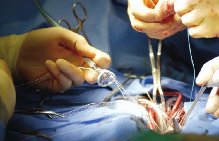 Surgical Services The Heart & Vascular Center provides surgical care for thousands of patients every year.