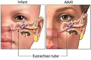 Mechanism of ear infection The small space behind the eardrum in the middle ear is normally filled with air. It is connected to the back of the throat by a tiny channel called the Eustachian tube.