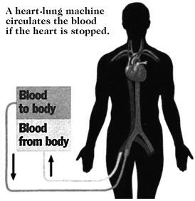 Close incision Heart-Lung (Bypass) Machine Heart