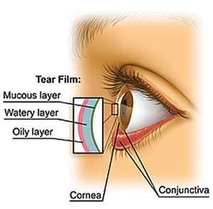 Role of the tear film Creates optically uniform surface across cornea Lubricates all tissue on ocular epithelium The Tear Film Cleanses