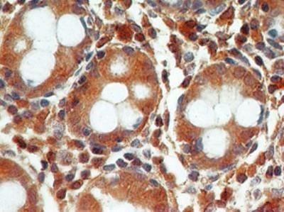 Staining in the nucleus is considered to be an indication of active Caspase-3. In most cell types and model systems, cells with active Caspase-3 are undergoing apoptosis.