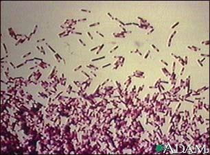 Clostridium difficile Clostridium difficile - first described in 1935 when it was isolated from stool samples of new-born