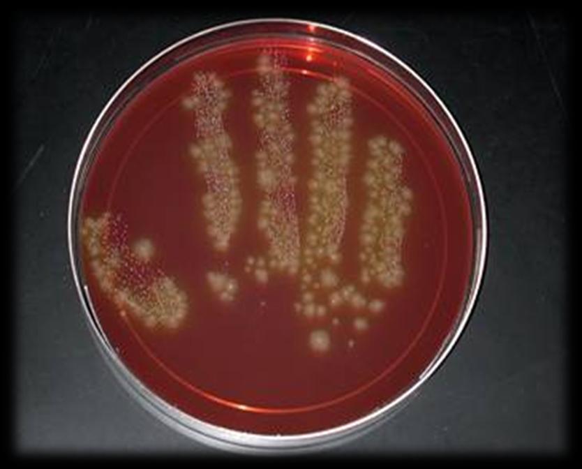 Hands and Gloved Hands as Sources for Spread Scientists cultured the imprint of a health care worker's gloved hand after examining a patient infected with Clostridium difficile.