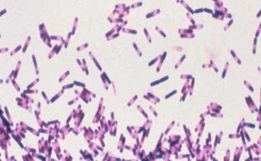 Overview: Clostridium difficile Anaerobic spore-forming bacillus Clostridium difficile Infection (CDI) Pseudomembranous
