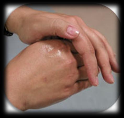 ALCOHOL-BASED HAND RUB Not Effective Against C.