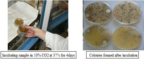 temperature (25 C) and incubated in CO2 and anaerobic culture systems.