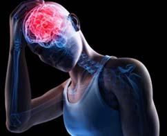 Symptoms and signs of a concussion that persists for weeks to months after the incident ICD 10 three or more of the following HA, fatigue,