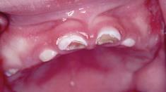 Oral Health and Dental Emergencies Maryland
