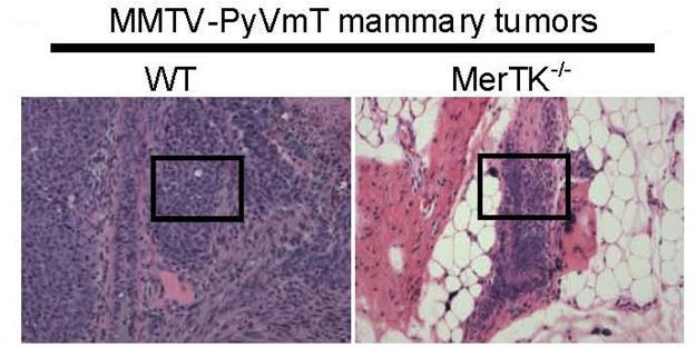 activation promotes M2 phenotype: anti-inflammatory effect Breast Melanoma MerTK is a