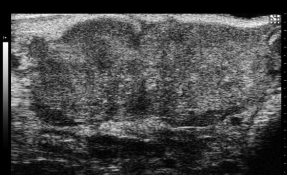 05 0-3 4 9 14 Tumor growth or orthotopically implanted KPC cells was assessed by ultrasound.
