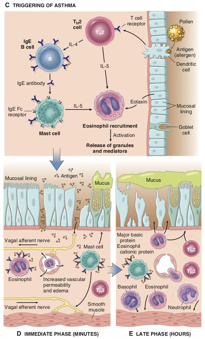 Pathogenesis of Bronchial Asthma 3. Activate TH2 cell and the release of cytokines such as IL-5 and IL-4.