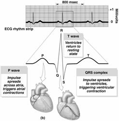 The Heart Electrical Activity Recorded, The ECG ECG records the electrical activity of the heart during