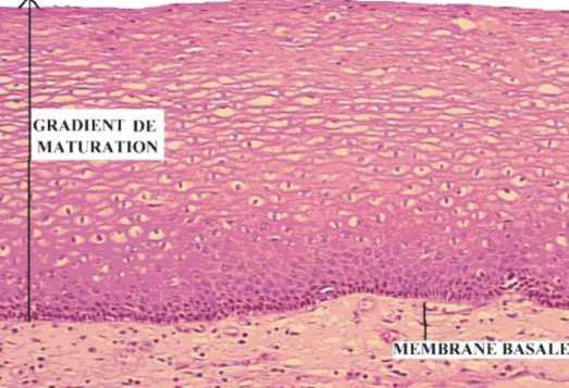 Normal epithelium - Note that this epithelium is composed of several layers of squamous cells.