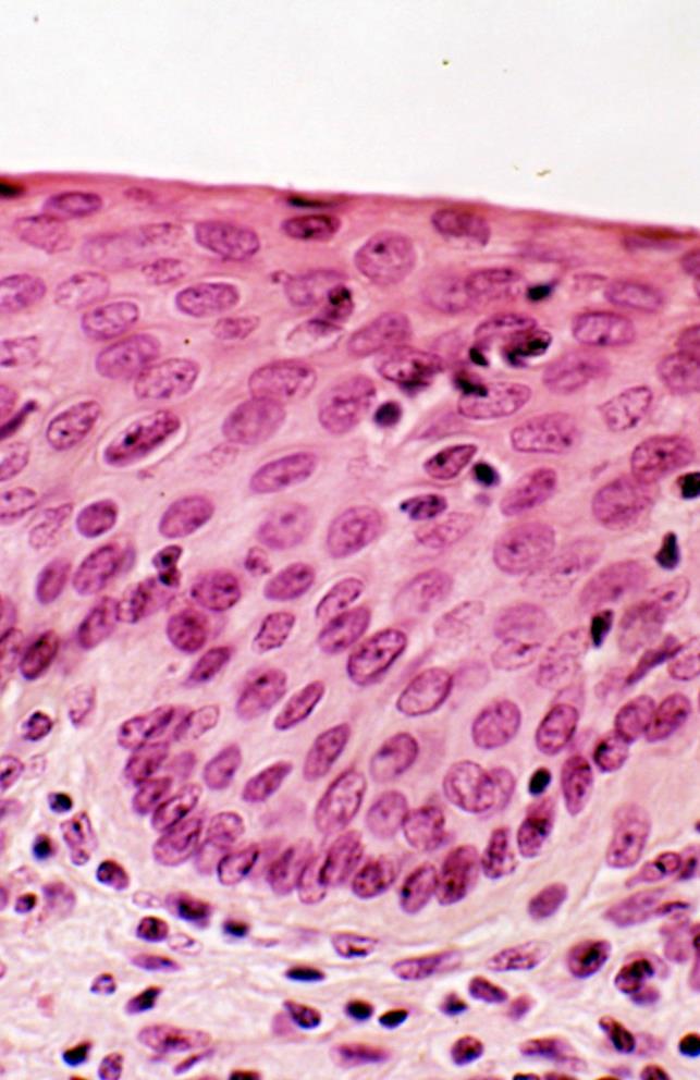 Basal layer in normal epithelium Note the cells with arrows at the base of