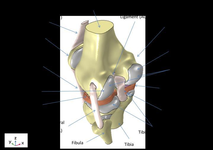 Figure 4 below, displays the difference between these models by presenting the tibia, tibia cartilage (on both medial and lateral sides), the menisci, and the removed defects on the medial meniscus