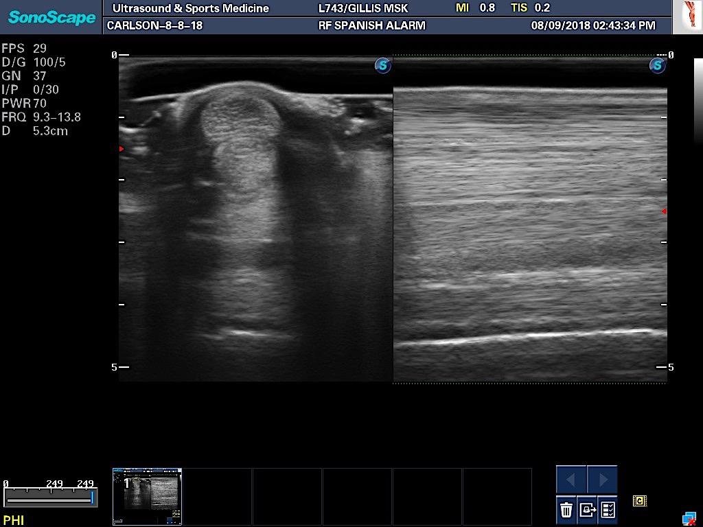 Diagnostic Ultrasound Provides the most detailed
