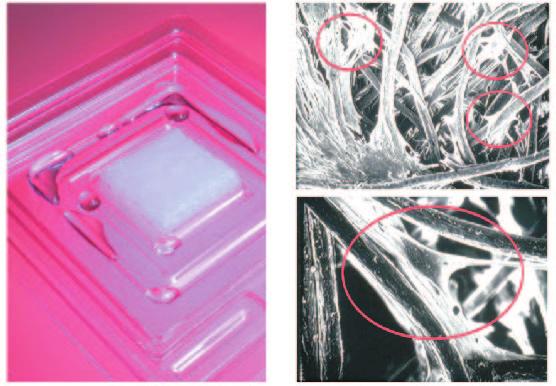 Figure 1. In vitro cultivation of keratinocytes onto a hyaluronic acid membrane (HA). Notice the keratinocytes (red arrow) passing through the holes of the resorbable HA support. Figure 2.