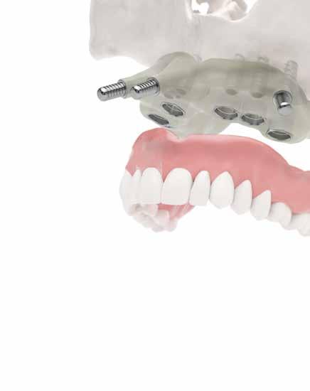 DIGITAL DENTISTRY CUSTOM-MADE MEDICAL DEVICES SURGICAL GUIDES AND ANATOMICAL MODELS High-definition 3D prints