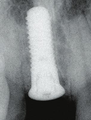 Fig. 19 The occlusal view clearly shows the tensionfree primary closure with no