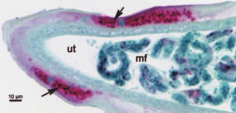 Wolbachia endobacteria in filarial disease 99 Fig. 2. Wolbachia bacteria in a section of female Brugia worm. Section of female B.