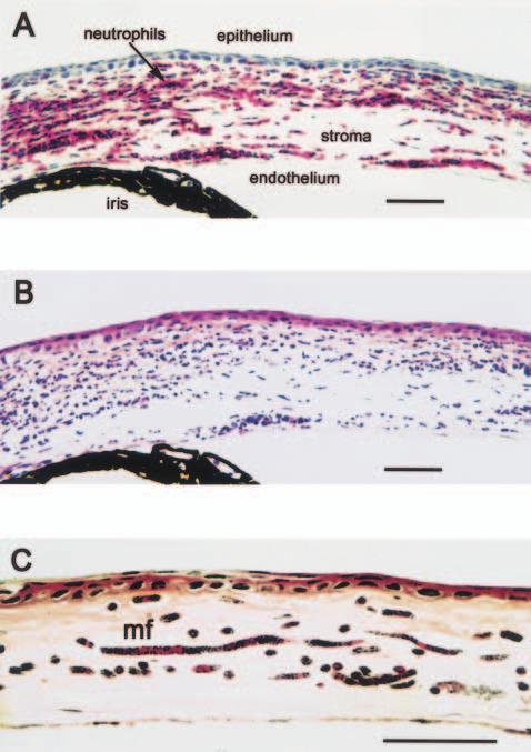 100 A. G. Hise, I. Gillette-Ferguson and E. Pearlman Using a mouse model of onchocerciasis in which microfilaria antigens are injected directly into the stroma of the cornea (see Fig.
