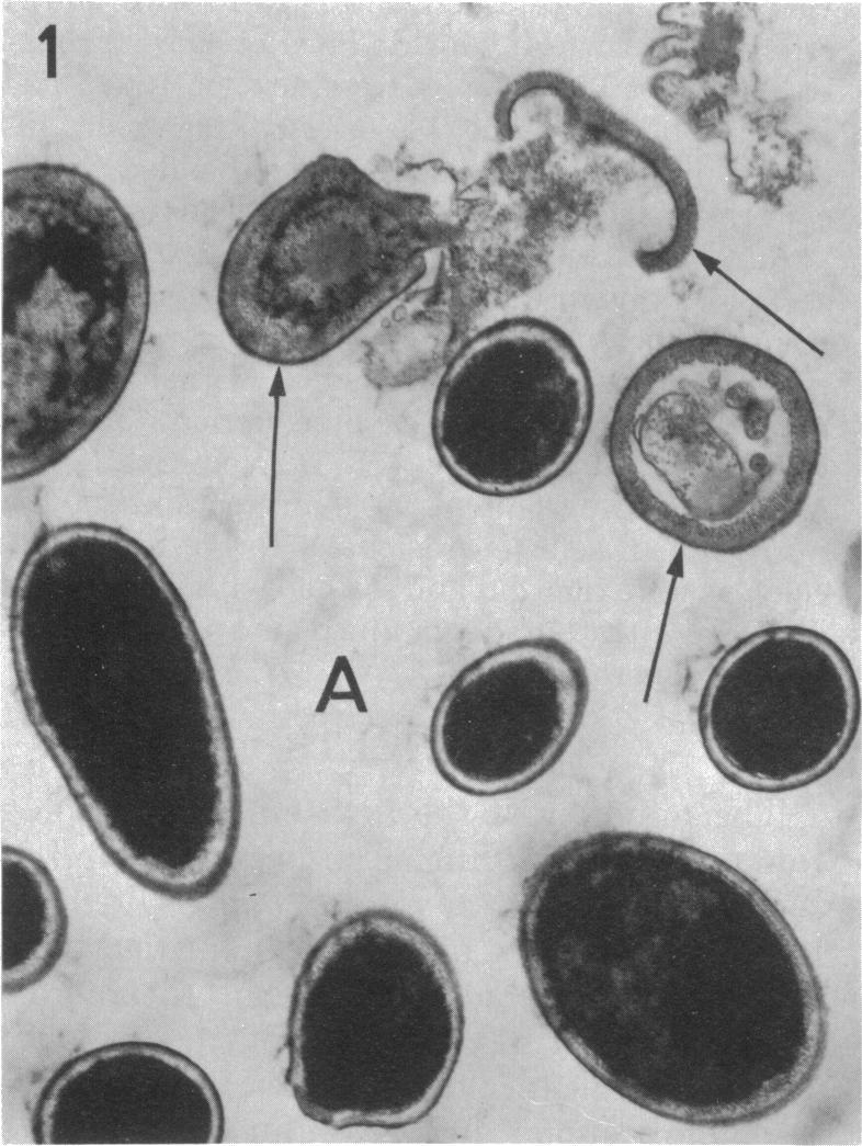 1140 JOSH, GAVN, AND ARMGER consisted of granular, amorphous, and fibrillar components. The apparently viable cells were of various sizes (Fig. 1), often showed evidence of budding (Fig.