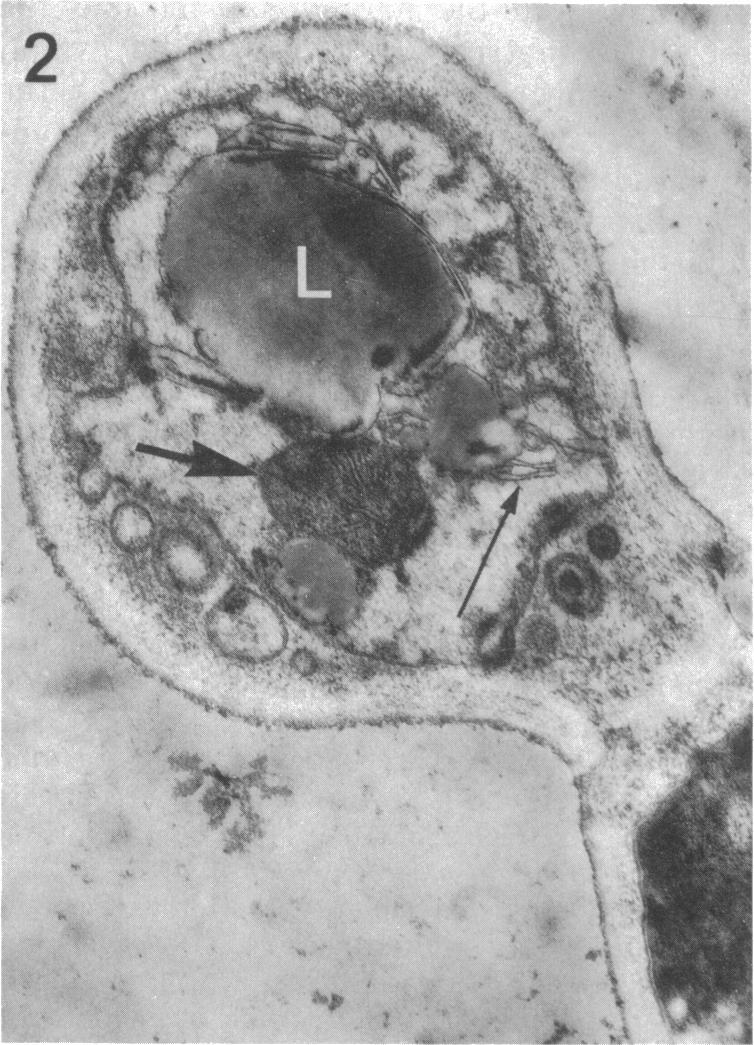 On the other hand, degenerate cells tended to be larger and more irregular in shape and had cell walls and cell contents which stained less deeply with PAS and ninhydrin (Fig. 3).