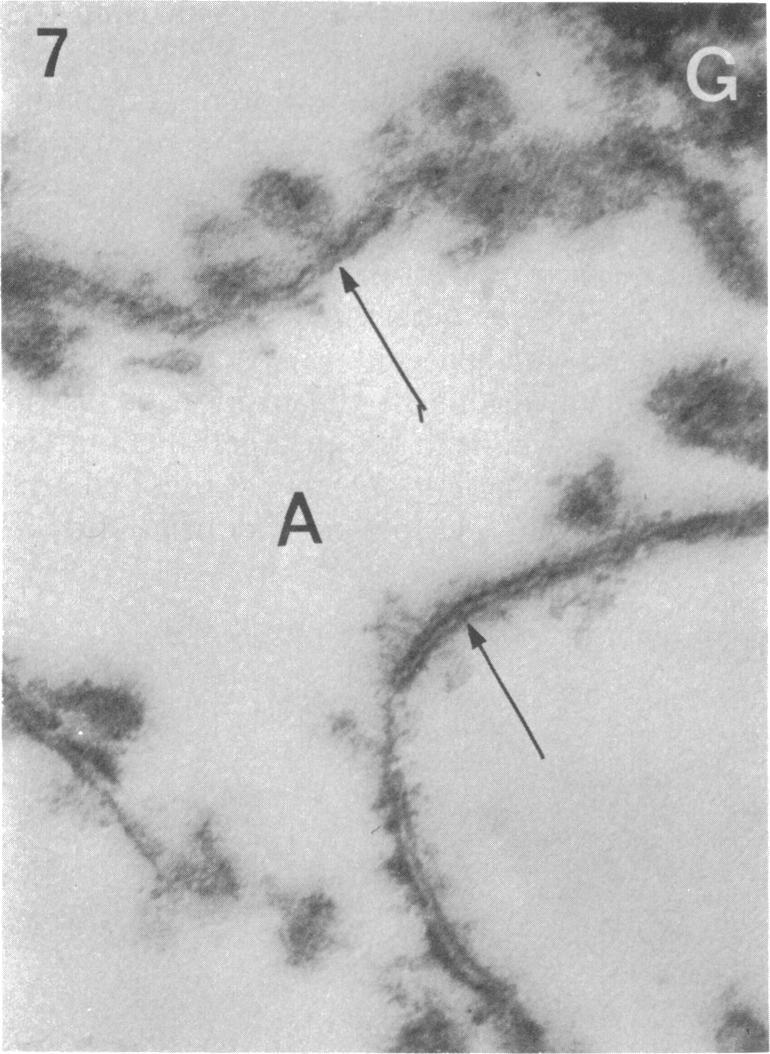 1142 JOSH, GAVN, AND ARMGER -A FG. 7. Trilaminar strands (arrows) lying in amorphous matrix (A) close to granular material (G) in a colony of C. albicans. x36,000. J. BACTEROL.