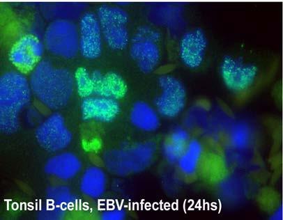 Latent EBV infection of resting B cells