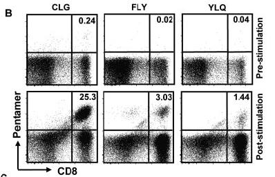 Adoptive transfer: Successful in PTLD Not so much in HL, BL, NPC - generation of CTLs with LCL stimulation primarily expand T cell responses specific for the latent EBNA3, 4, 6 antigens, not