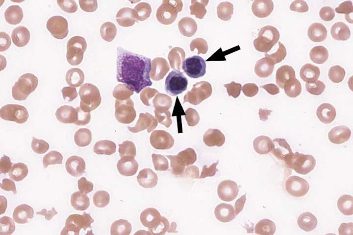 Cell Identification VPBS-02 nrbc, norm/abn morphology 833 85.5 Educational Lymphocyte 118 12.1 Educational Lymphocyte, reactive 19 2.