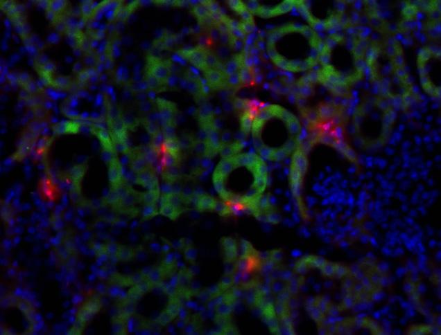 Supplementary Figure 5 (Mu) Cell tracker labeled CD8Ts & auto fluorescence & DAPI Kidney Spleen Heart Supplementary Figure 5 Fresh isolated CD8 + T cells