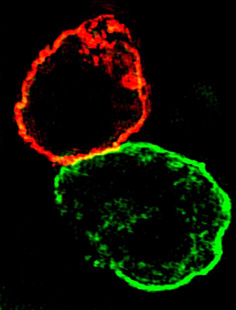 As expected, the staining of Na-K-ATPase (green) on mdct membrane was much stronger compered to TK membrane.