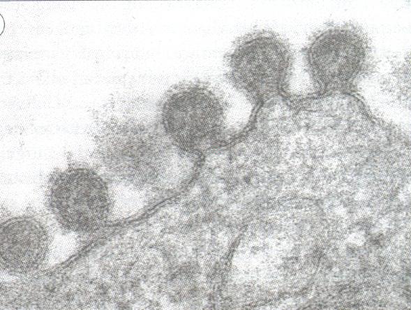 Pandemic Influenza October 9, 2006 1918 influenza epidemic: realization of