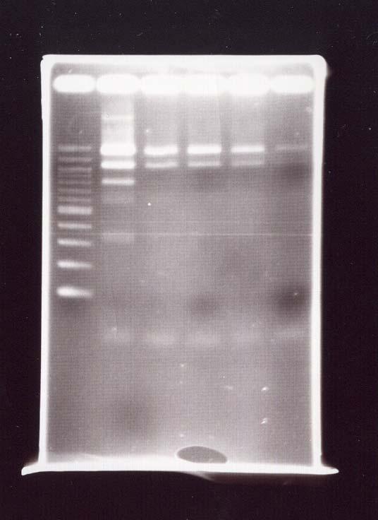PCR results from xxxx