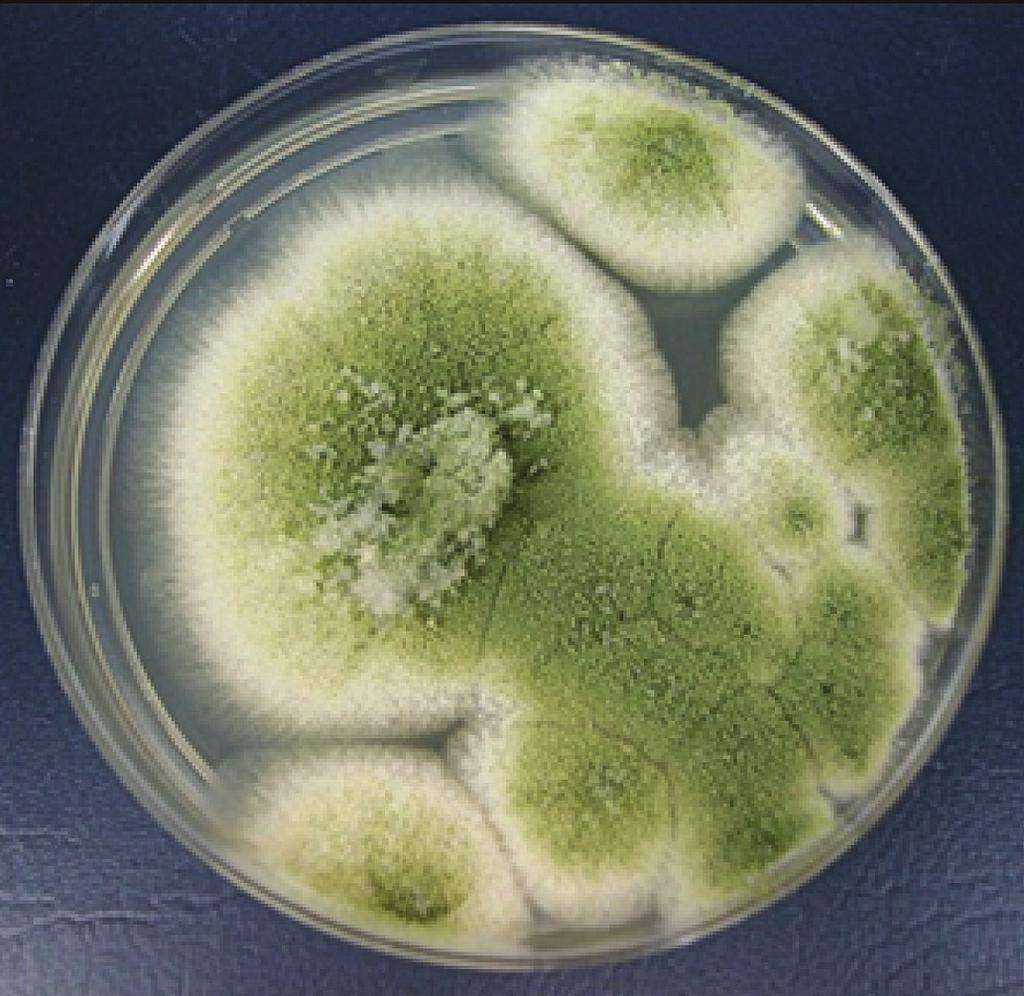 Aspergillus flavus Essential Facts Culture Characteristics: Aspergillus flavus grows moderately rapidly, producing a yellow-green colony often with white border.