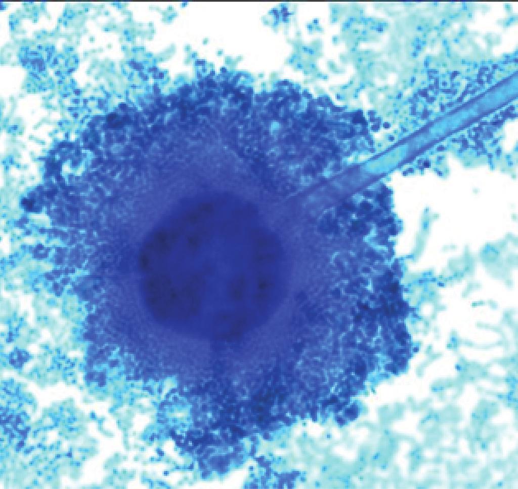 Microscopic Morphology Figure 28-3. Aspergillus flavus demonstrates a large globose vesicle covered with phialides (lactophenol aniline blue, original magnification x400). Figure 28-5.