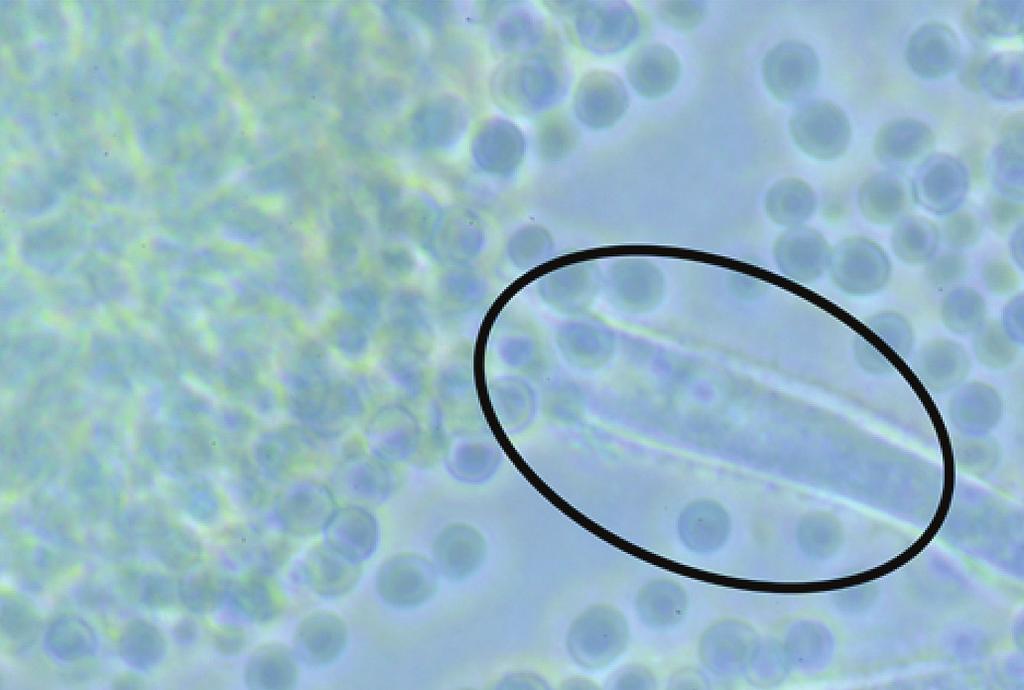 Aspergillus flavus forms long conidiophores (400-800 µm) with globose vesicles. Two vesicles from which conidia have been stripped are circled, and the round vesicle shape is easy to see.