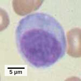 OpenStax-CNX module: m45542 5 Figure 3: Lymphocytes, such as NK cells, are characterized by their large nuclei that actively absorb Wright stain and therefore appear dark colored under a