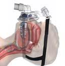 Improved Outcome of Full Face Mask CPAP Treatment with Mandibular