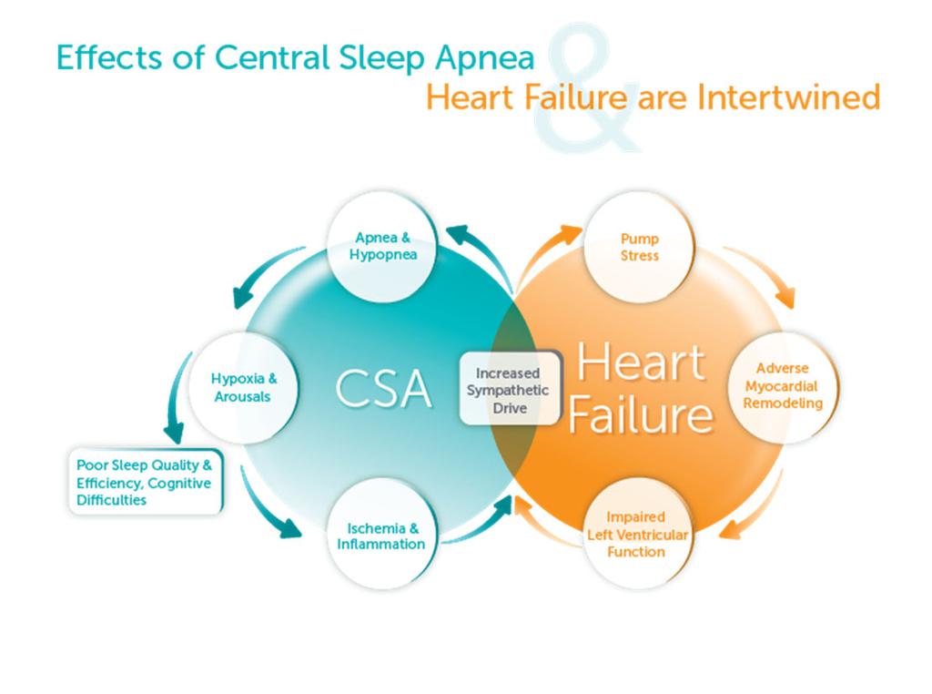 , JACC, 2015 The Effects of Central Sleep and Heart Failure are Intertwined Somers NEJM