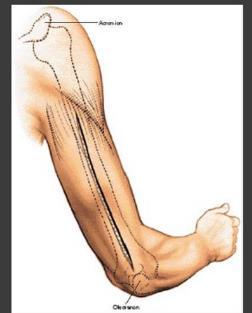 Posterior Better for more distal fractures Tip of olecranon distally to