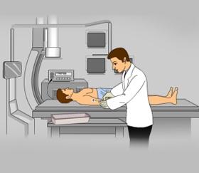How is it Performed? An angiogram is performed by a radiologist, a doctor specialized in X-ray tests. The patient is positioned on their back on the examination table by the radiologist.