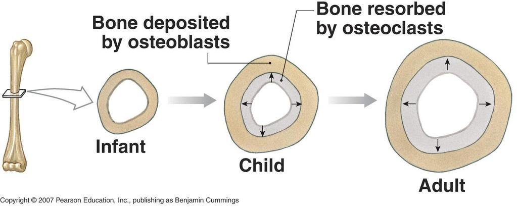 Appositional Bone Growth Growing bones widen as they lengthen Appositional growth growth of a bone by addition of bone tissue to its surface Bone is resorbed at endosteal