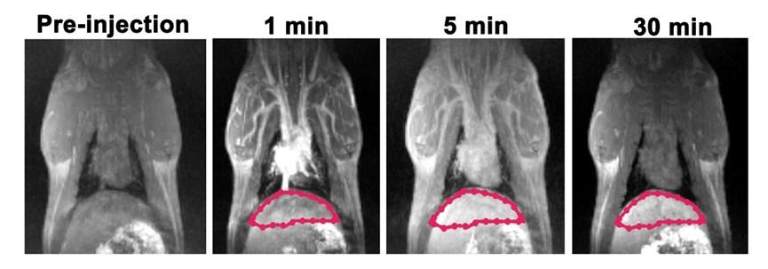 Figure S7 T 1 -weighted images of SD rats pre-injection and post-injection (p.i.) of Ibu-Gd at a dose of 0.