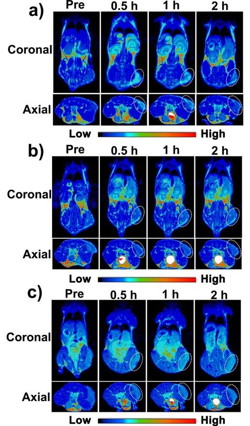 Figure S9 T 1 -weighted MR imaging and quantitative analysis of subcutaneous H22 tumors after intravenous injection of Ibu-Gd-BSA NPs, Ibu-Gd, or Gd-DOTA.
