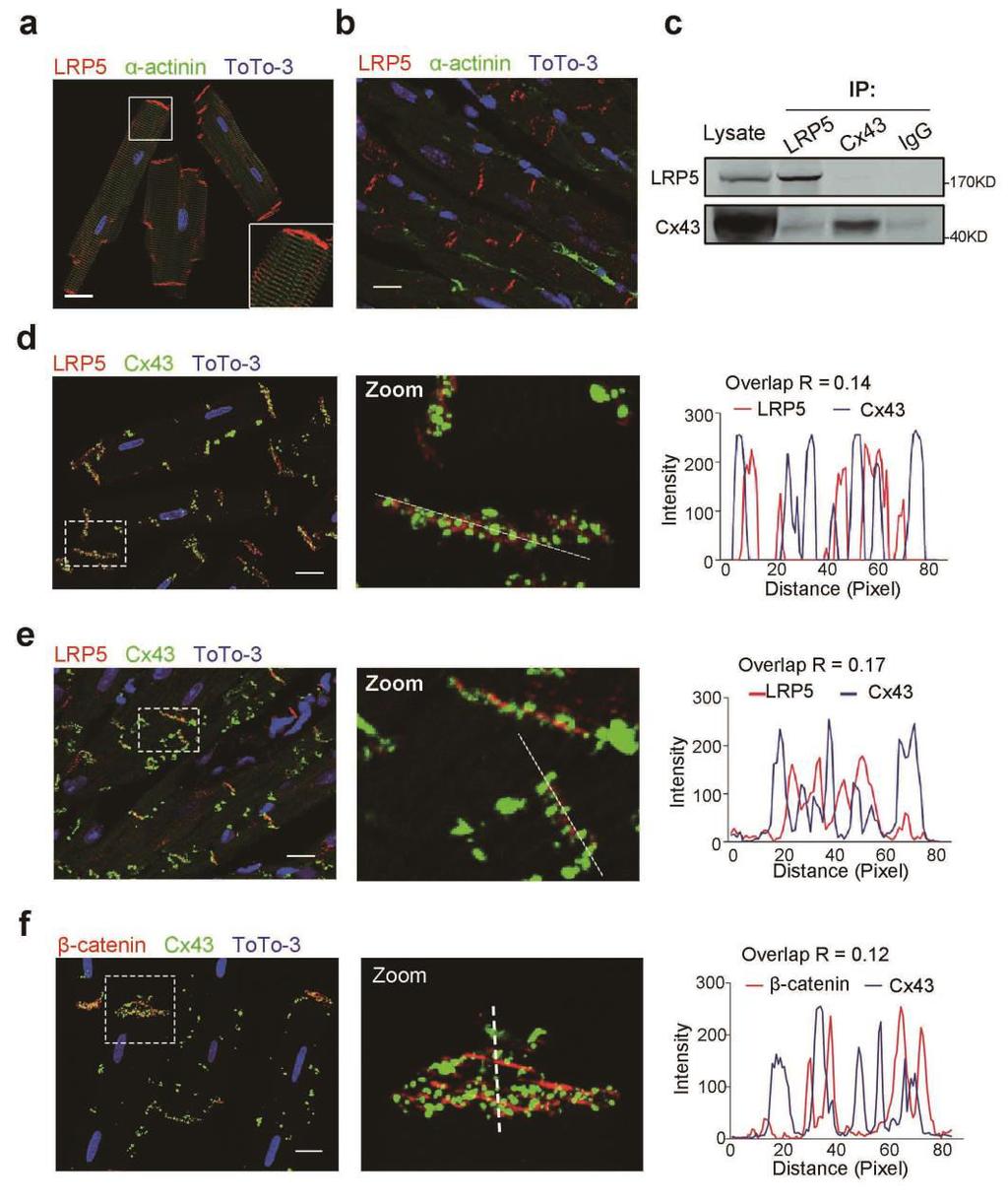 Supplementary Figure 1. Spatial distribution of LRP5 and β-catenin in intact cardiomyocytes.