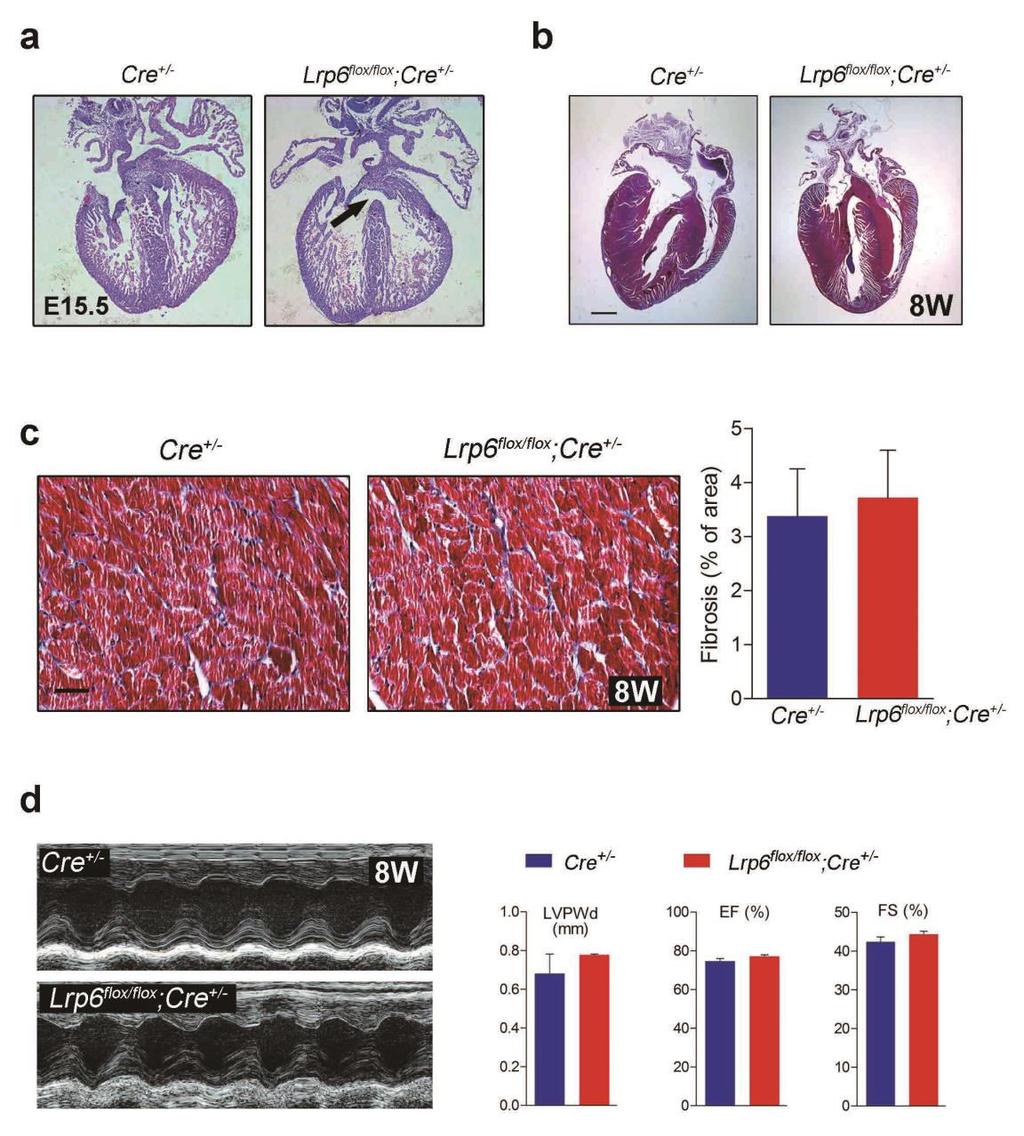 Supplementary Figure 9. Effects of Lrp6 CKO on cardiac structure and function. (a) and (b) Immunohistochemical analysis of the Lrp6-knockout embryonic and adult hearts. Scale bar, 1 mm.
